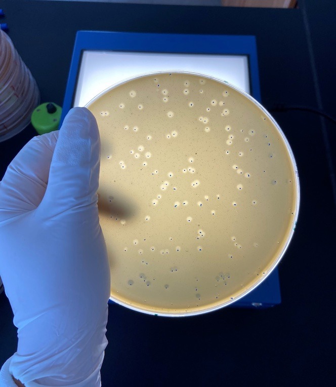Viruses from wastewater cultured on a petri dish at MASSTC.